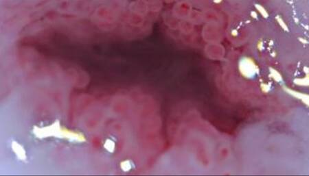 Cervix Closeup Heartbeat 4K