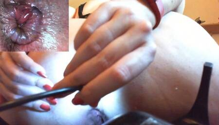 Extreme anal endoscope session avi