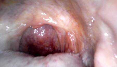 Holy uvula! Endoscope camera used