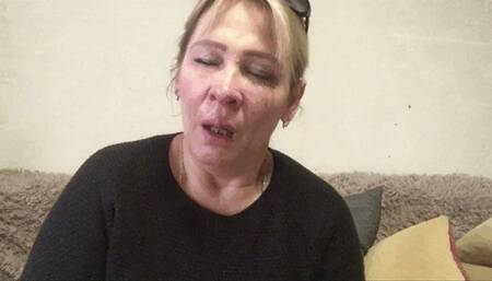 Abundant sneezing until a snotty nose splashes and tears  wmv