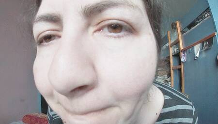 Wet, allergic nose