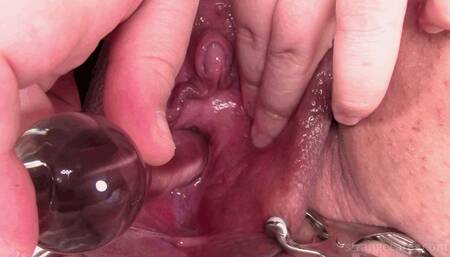 how does it feel to go into the bladder (1080 wmv)