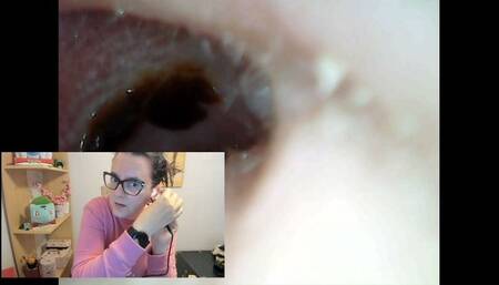 Full screen otoscope dirty ears painful cleaning