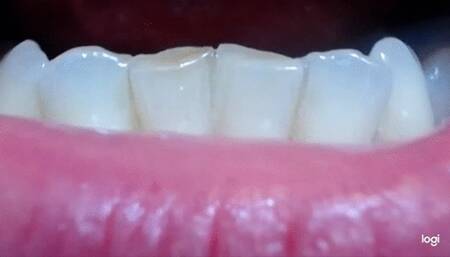 6 minutes down teeth to cam mp4