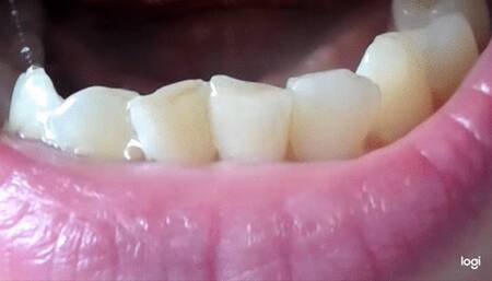 8 minutes of my teeth to cam mp4