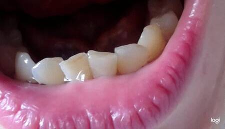 20 minutes of my down teeth to cam mp4