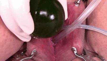 1st egg experience + bladder filling too