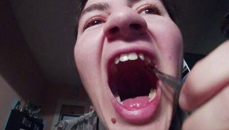 Looking for the tonsil stones, got it, smashing and smelling