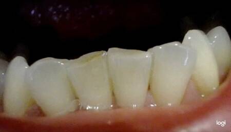 50 minutes of my teeth to cam no sound