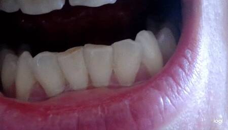 13 minutes of down side teeth to cam mp4