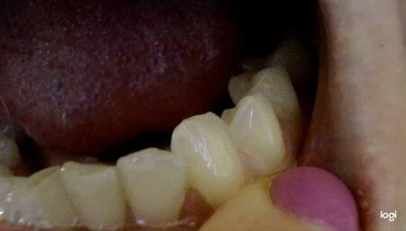 Teeth 4 minutes No sound No audio mp4