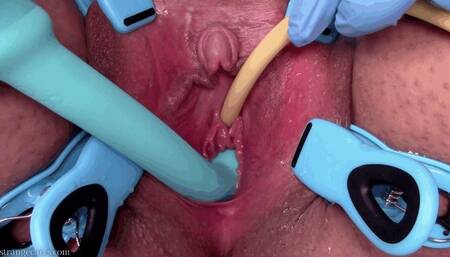 catheter and g-spot vibrator (1080 wmv)