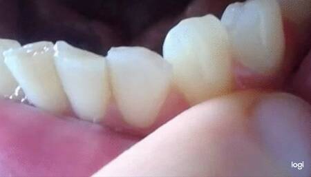 5 minutes my down teeth to cam mp4