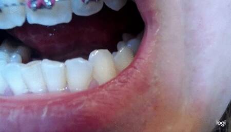 16 minutes my teeth canines to cam No sound No audio mp4