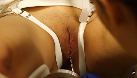 Mila's Medical Stapling and Orgasm Treatment by Nurse Roxy WMV