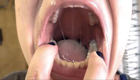 Teeth brushing and mouth check