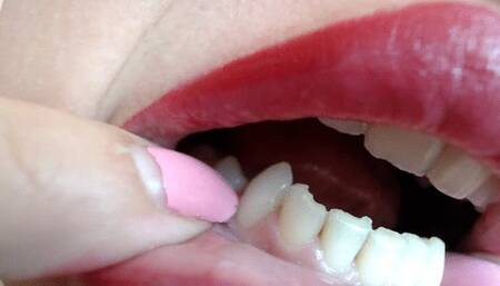 Weird Stasha's teeth