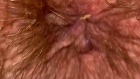 Close up hairy ass hole