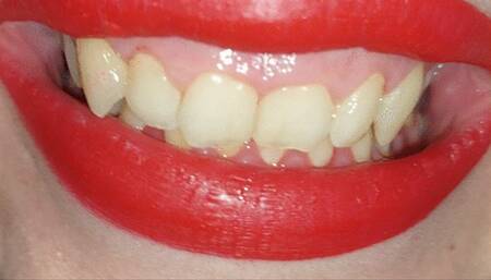 I move my tongue and then I touch my lips