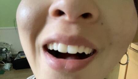 Aurora's Nose Is Amazing Part 2