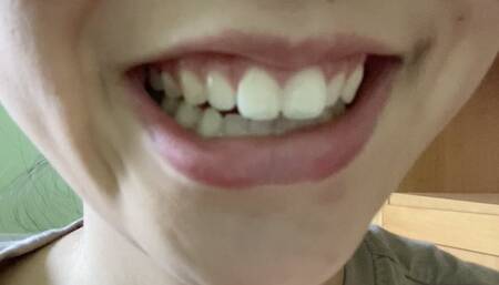 Aurora's Teeth Tease You Madly Again