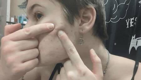 Mini Zit Popping Clip 2