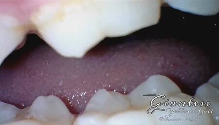 Side view of a gummy chewing