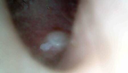 Ear surgery part one