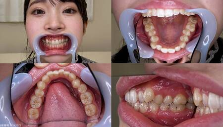 Hikaru - Watching Inside mouth of Japanese cute girl bite-200-1 - wmv 1080p