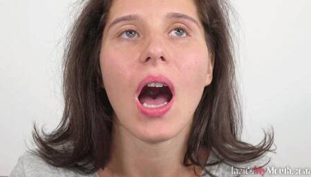 Inside My Mouth - Nikol got a mouth exam (MOBILE)