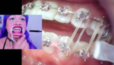 Lila Jordan, Suspenders, Braces