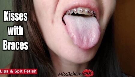 Kissing with Braces and Spit Play - Mouth & Tongue Fetish - Brackets - MissBohemianX - SD MP4