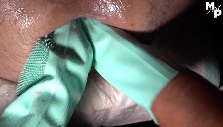 Extreme fisting with rough rippled cleaning gloves