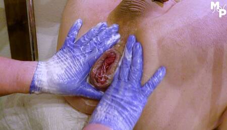 Femdom fisting and prolapse training