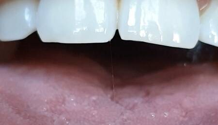 Tarual light mouth tour