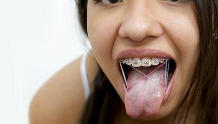 BRACES + Rubber bands ORAL SEX Elastics bands on Teeth 18yo Blowjob
