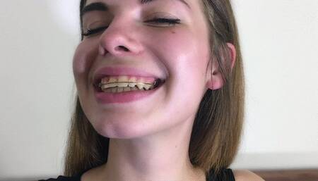 Klara’s Braces For First Time - HD 1920x1080