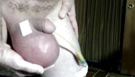 Playing with 1000mL Saline infused scrotum with catheter