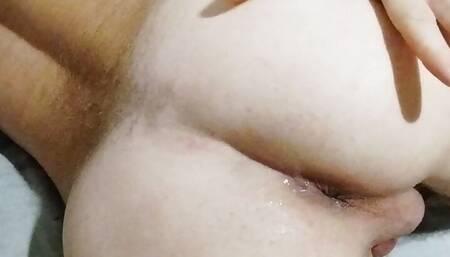 Anal