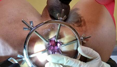 Pakistani Bitch Stretches Asshole with Anal Speculum