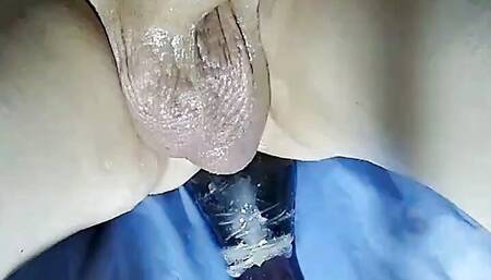 Anal insertion