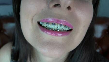 JOI - Weronika - Cum On My Braces - UHD 3840x2160 - 4K