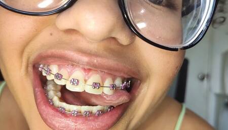 INSIDE My Mouth - SweetMari17 - Tongue, Teeth, Braces and Mouth Fetish