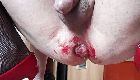 Sissy Oksana tore her asshole with a huge bottle but got sissygasm_Asshole gape closeup