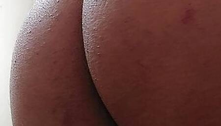 Ass hole showing