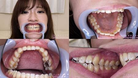 Sara - Watching Inside mouth of Japanese cute girl bite-222-1 - wmv 1080p