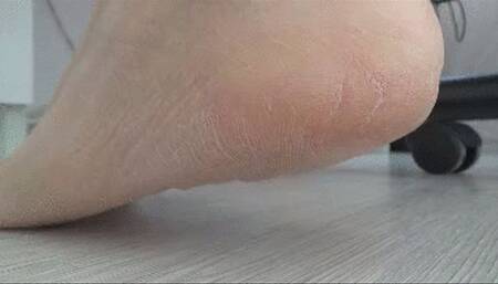 DRY AND WRINKLY SOLES (cl)