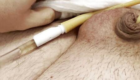 BBW with small dick with bladder catheter and swollen balls: he cums a lot!