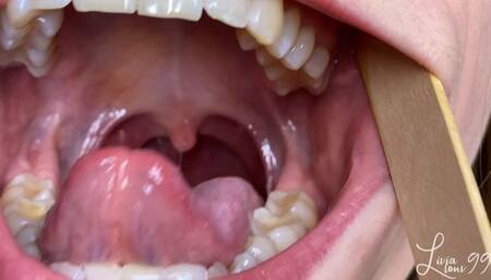 Mouth, teeth, tongue, uvula exploration full HD mp4