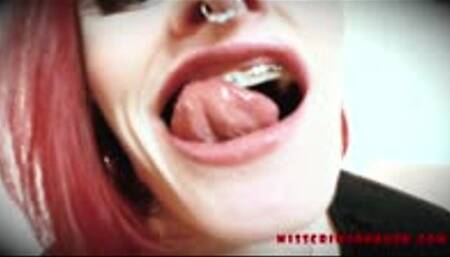 Stroke to My Braces (CUSTOM)